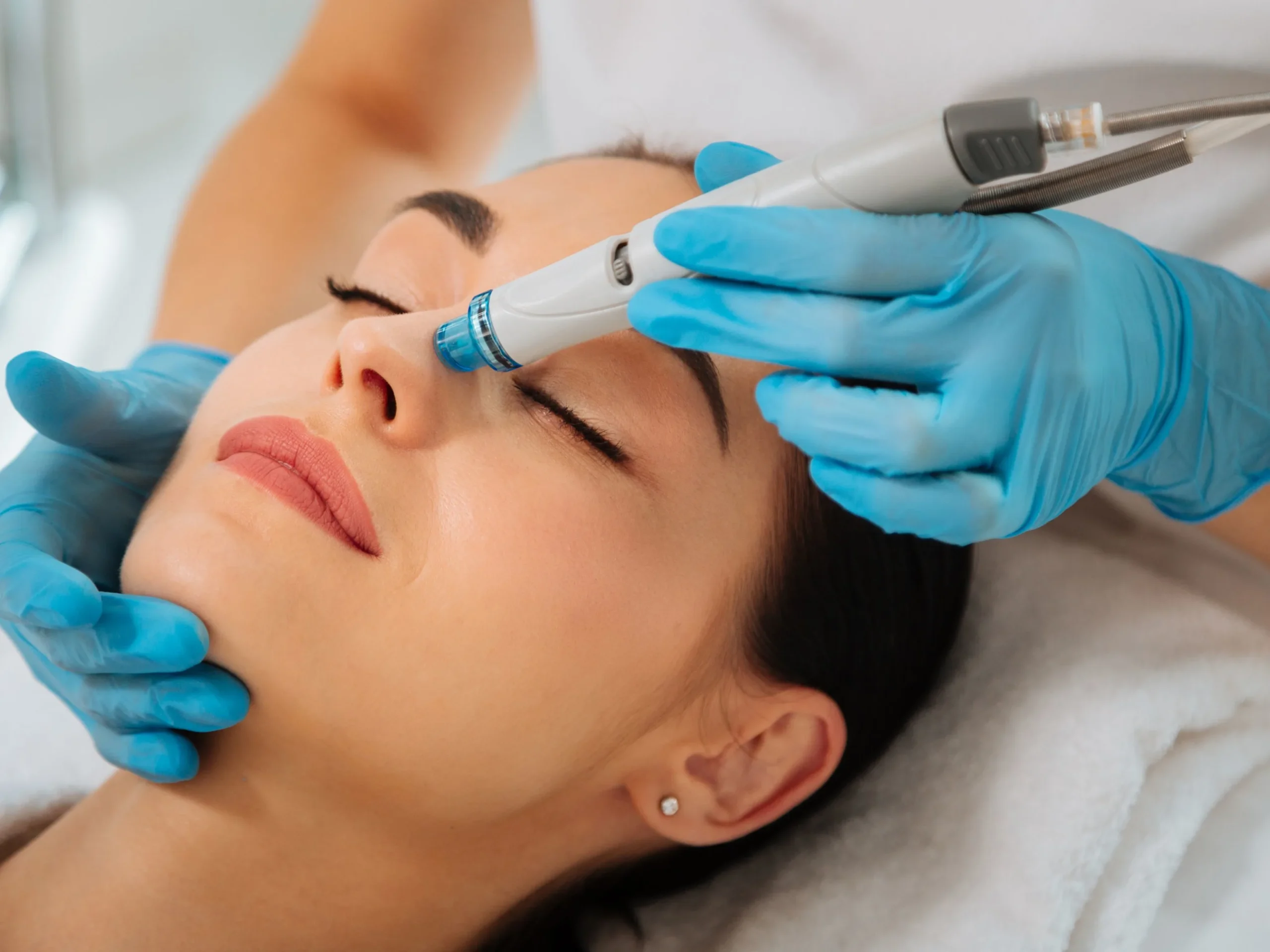 Hydra Facial Treatment in Dubai at Belle Cosmetic Clinic