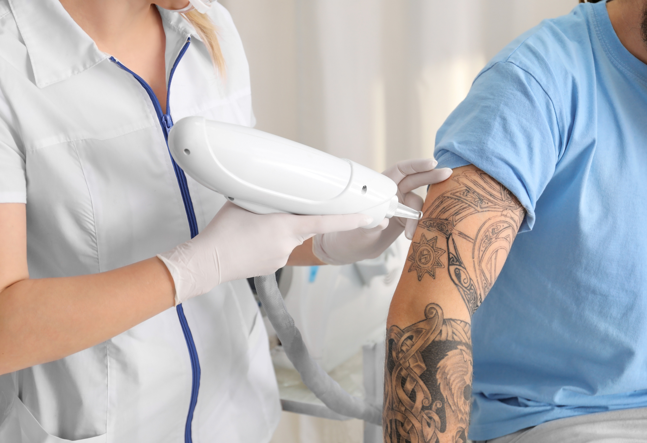 Types of Laser Technologies for Tattoo Removal at Belle Cosmetic Clinic