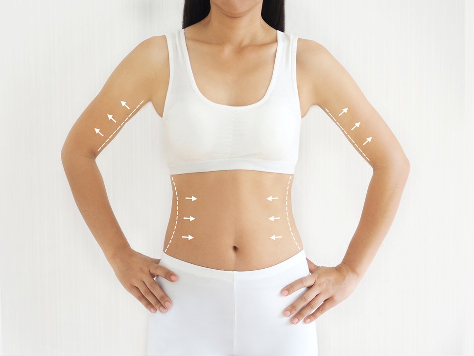 Body Contouring Dubai