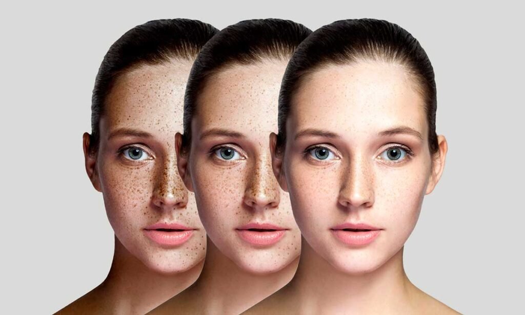 Peptide Pen Brightening Dubai