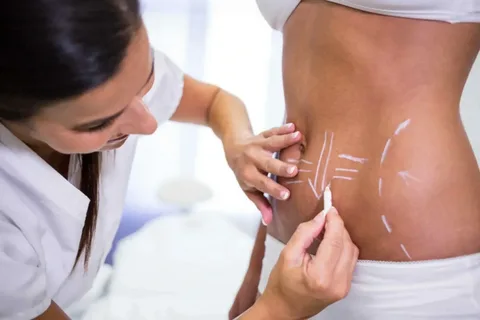 Fat Reduction Dubai