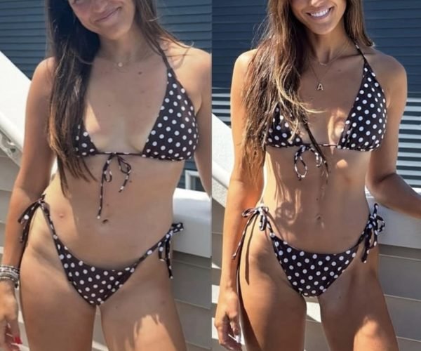 Body Sculpting Toning Before After Case 160